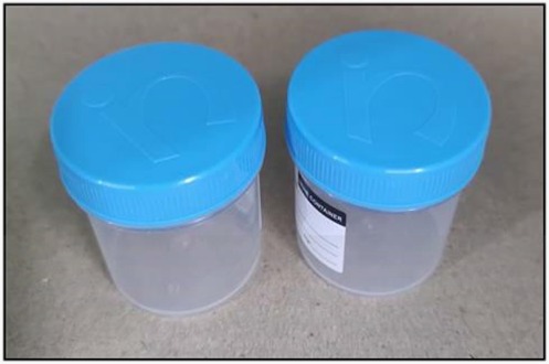 URINE CONTAINER 50ML